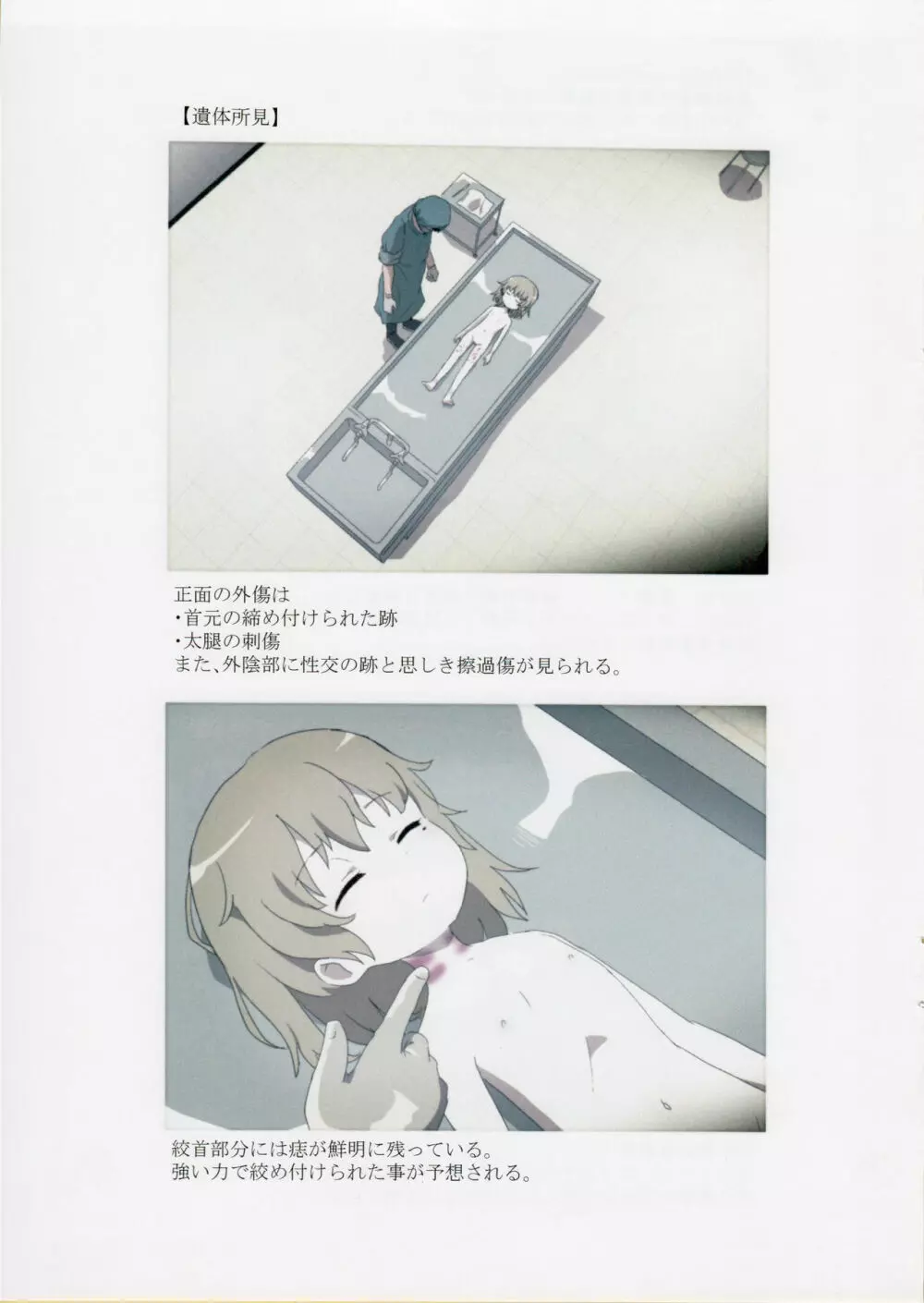 西荻窪少女殺害事件司法解剖記録 - page4