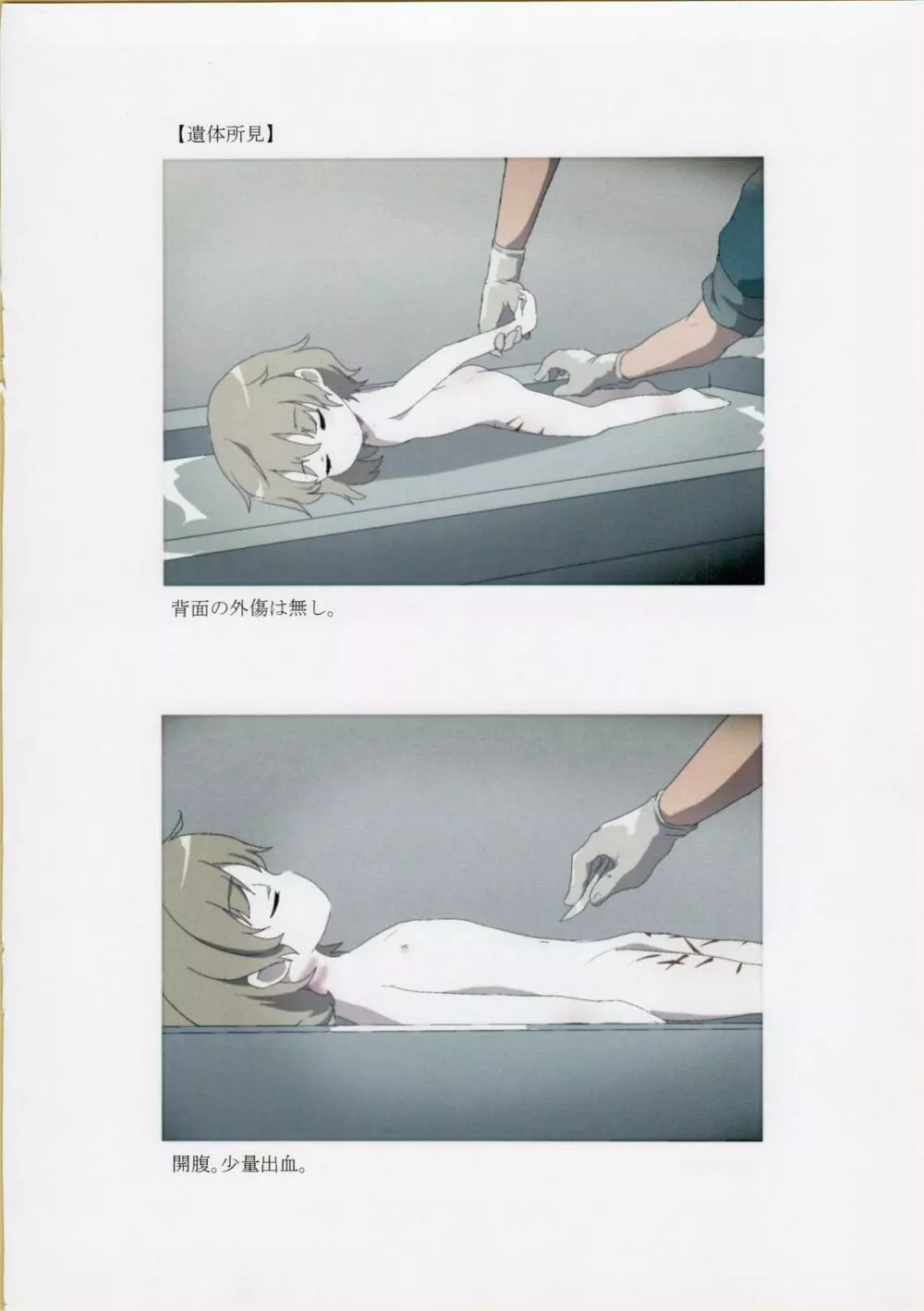 西荻窪少女殺害事件司法解剖記録 - page5