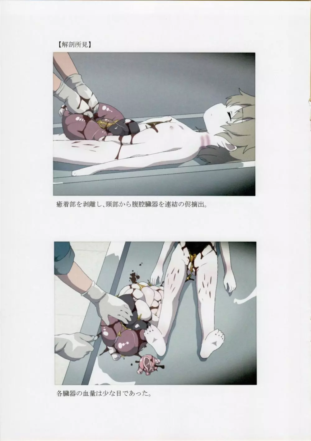 西荻窪少女殺害事件司法解剖記録 - page8