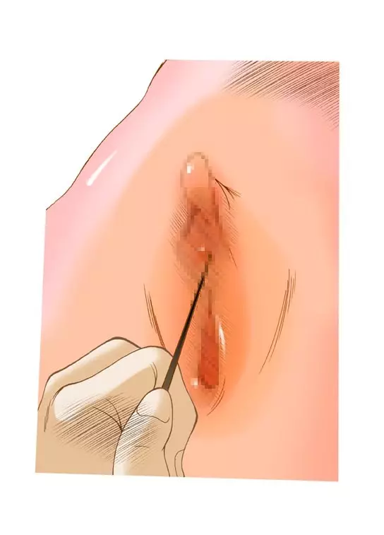 S-DOG懲罰 針の罰 - page29