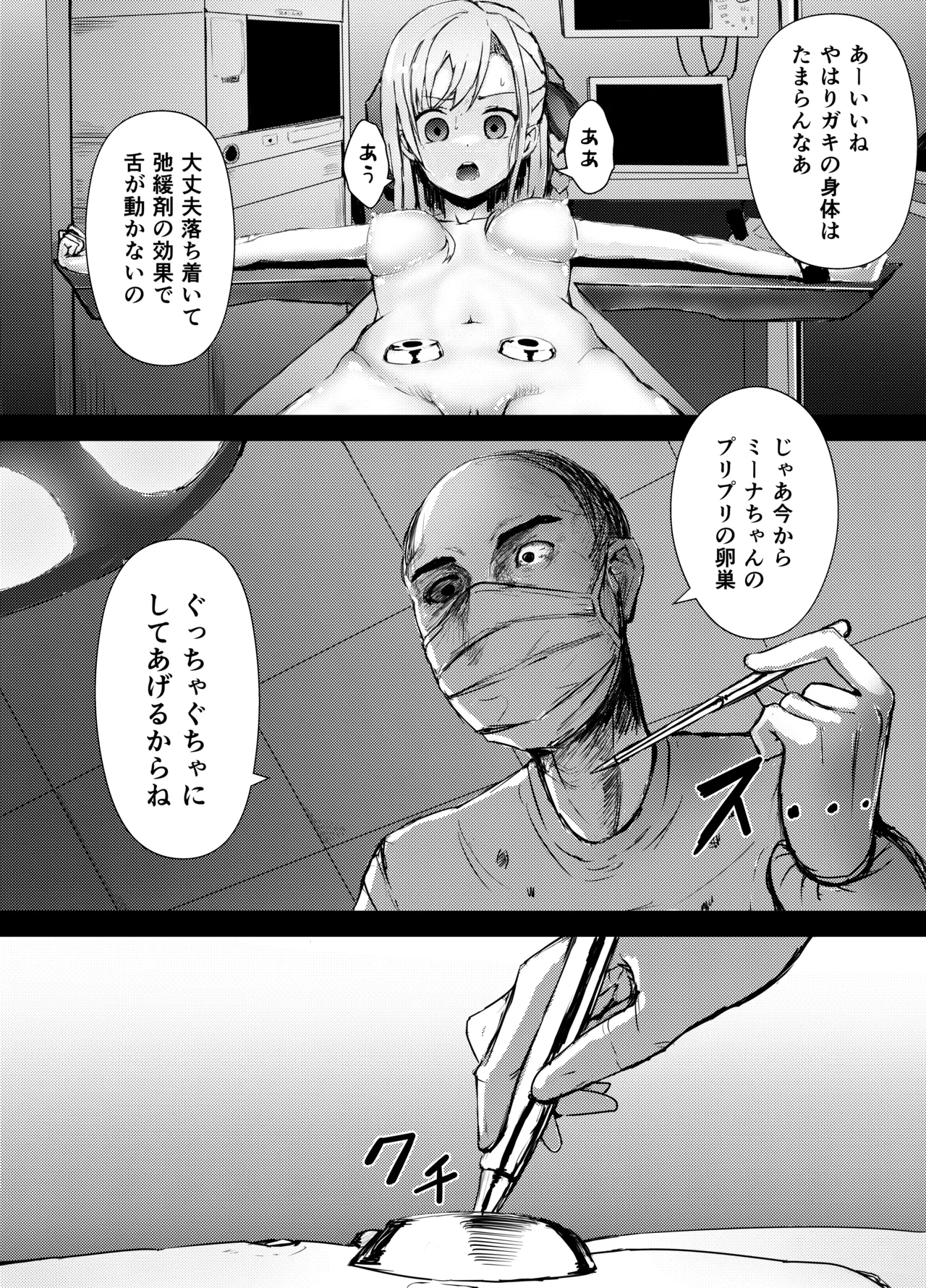 ヴィルヘルミーナちゃん リョナ