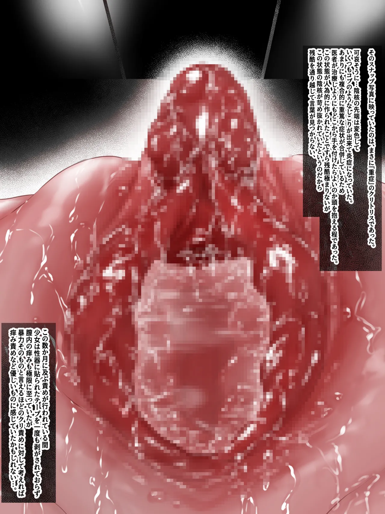 拘束少女器具責め漫画 女体器具蹂躙～完全拘束少女／クリ肥大化実験／無限ディルド機械姦／性器徹底集中責めなど～ - page110